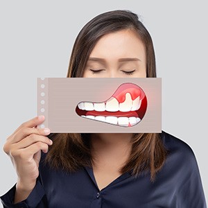 woman holding an image of infection gums in front of her face