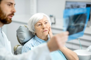 Older woman worried before dental implant salvage