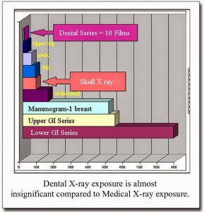 dental radiation exposure comparison chart